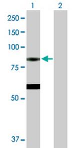 EPX Antibody in Western Blot (WB)