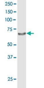 ACOX2 Antibody in Western Blot (WB)