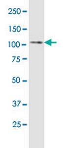 ULK1 Antibody in Western Blot (WB)