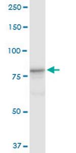 CUL4A Antibody in Western Blot (WB)