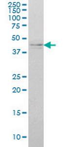 IKBKG Antibody in Western Blot (WB)