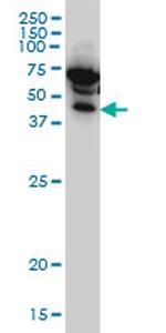 IKBKG Antibody in Western Blot (WB)