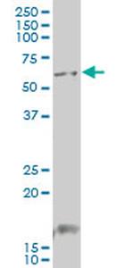 GCM1 Antibody in Western Blot (WB)