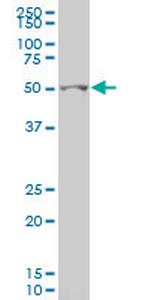 GCM1 Antibody in Western Blot (WB)