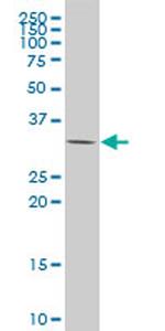 CSDA Antibody in Western Blot (WB)