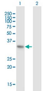 PIR Antibody in Western Blot (WB)