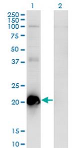 TCAP Antibody in Western Blot (WB)