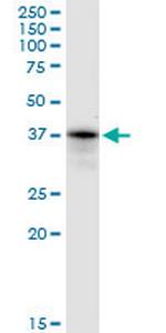 PRPF18 Antibody in Western Blot (WB)