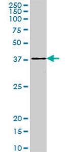 DEGS1 Antibody in Western Blot (WB)