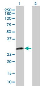 DENR Antibody in Western Blot (WB)