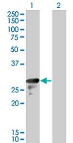 DENR Antibody in Western Blot (WB)