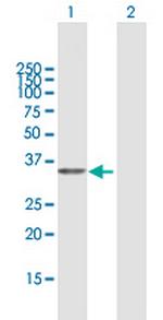 PDXK Antibody in Western Blot (WB)