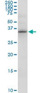 PDXK Antibody in Western Blot (WB)