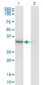 PDXK Antibody in Western Blot (WB)