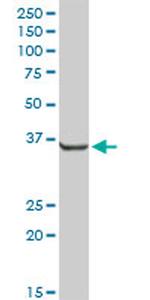 AKR7A2 Antibody in Western Blot (WB)