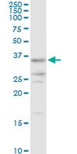 AKR7A2 Antibody in Western Blot (WB)