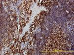 PRKRA Antibody in Immunohistochemistry (Paraffin) (IHC (P))