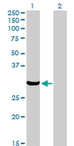 PRKRA Antibody in Western Blot (WB)