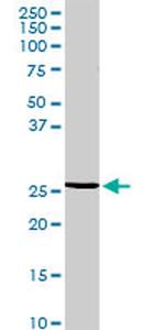 RGS20 Antibody in Western Blot (WB)