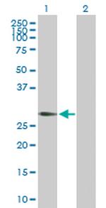 RGS20 Antibody in Western Blot (WB)