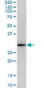 RGS20 Antibody in Western Blot (WB)