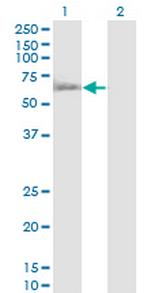 RUVBL1 Antibody in Western Blot (WB)