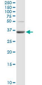 PPAP2A Antibody in Western Blot (WB)