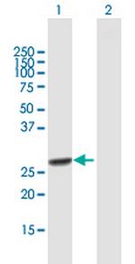 RFXANK Antibody in Western Blot (WB)