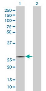 RFXANK Antibody in Western Blot (WB)