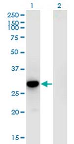 RFXANK Antibody in Western Blot (WB)