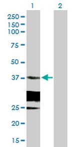 HSD17B6 Antibody in Western Blot (WB)