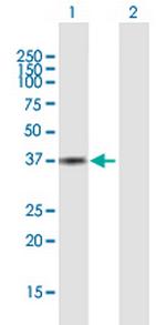 AKR1C3 Antibody in Western Blot (WB)