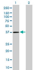 AKR1C3 Antibody in Western Blot (WB)