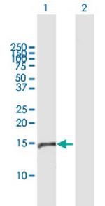 NUMB Antibody in Western Blot (WB)