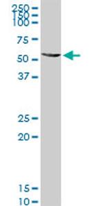 ALDH4A1 Antibody in Western Blot (WB)