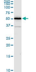 ALDH4A1 Antibody in Western Blot (WB)