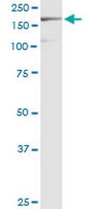 EIF3A Antibody in Western Blot (WB)