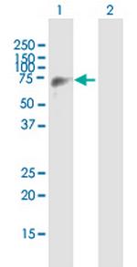 EIF4G3 Antibody in Western Blot (WB)