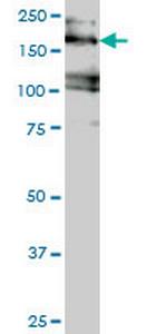 EIF4G3 Antibody in Western Blot (WB)