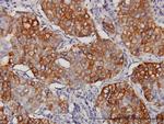 EIF4G3 Antibody in Immunohistochemistry (Paraffin) (IHC (P))