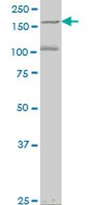 EIF4G3 Antibody in Western Blot (WB)