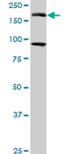 EIF4G3 Antibody in Western Blot (WB)