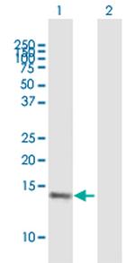 VAMP8 Antibody in Western Blot (WB)