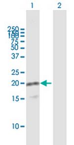 VAMP8 Antibody in Western Blot (WB)