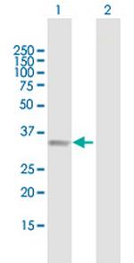 B4GALT2 Antibody in Western Blot (WB)