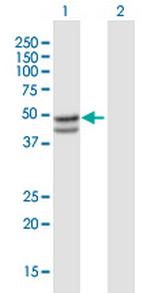 SERPINB7 Antibody in Western Blot (WB)