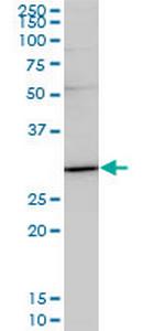 TRADD Antibody in Western Blot (WB)