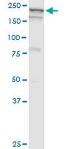 GBF1 Antibody in Western Blot (WB)