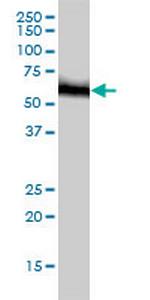 RNMT Antibody in Western Blot (WB)