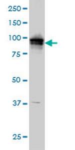 ADAM9 Antibody in Western Blot (WB)